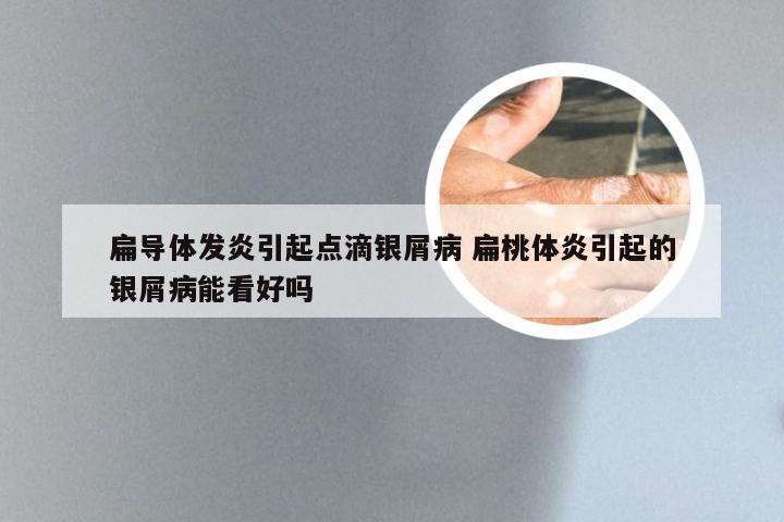 扁导体发炎引起点滴银屑病 扁桃体炎引起的银屑病能看好吗