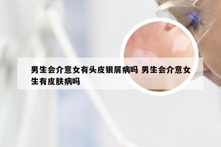 男生会介意女有头皮银屑病吗 男生会介意女生有皮肤病吗
