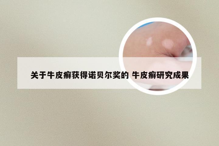 关于牛皮癣获得诺贝尔奖的 牛皮癣研究成果