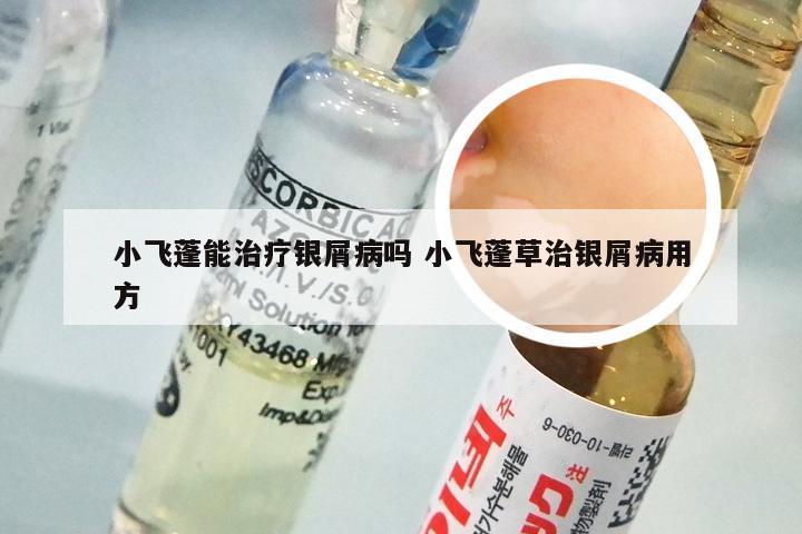 小飞蓬能治疗银屑病吗 小飞蓬草治银屑病用方