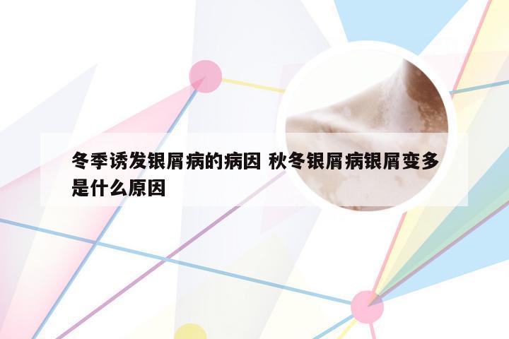 冬季诱发银屑病的病因 秋冬银屑病银屑变多是什么原因