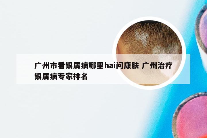 广州市看银屑病哪里hai问康肤 广州治疗银屑病专家排名