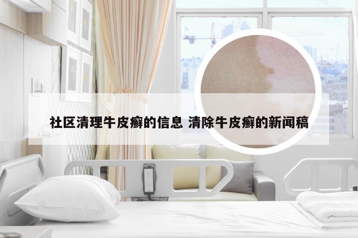 社区清理牛皮癣的信息 清除牛皮癣的新闻稿