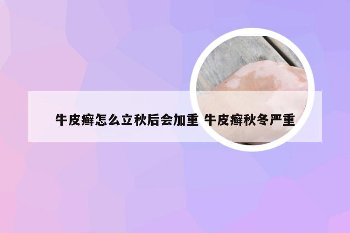 牛皮癣怎么立秋后会加重 牛皮癣秋冬严重