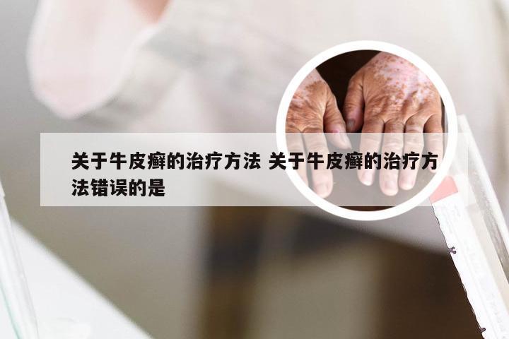 关于牛皮癣的治疗方法 关于牛皮癣的治疗方法错误的是