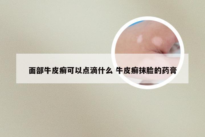 面部牛皮癣可以点滴什么 牛皮癣抹脸的药膏