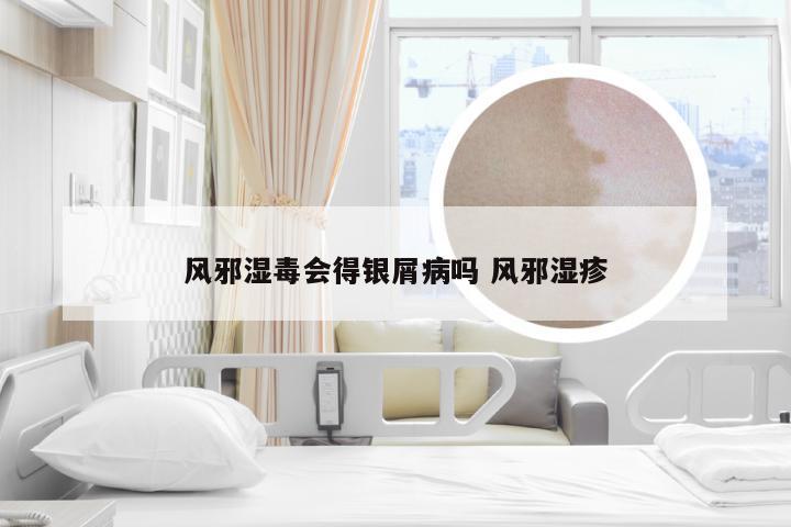 风邪湿毒会得银屑病吗 风邪湿疹