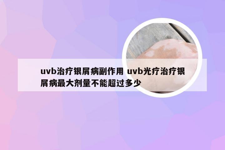 uvb治疗银屑病副作用 uvb光疗治疗银屑病最大剂量不能超过多少