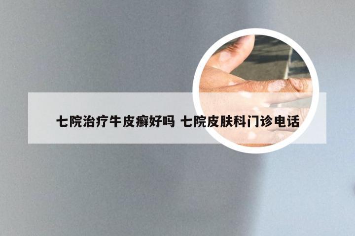 七院治疗牛皮癣好吗 七院皮肤科门诊电话