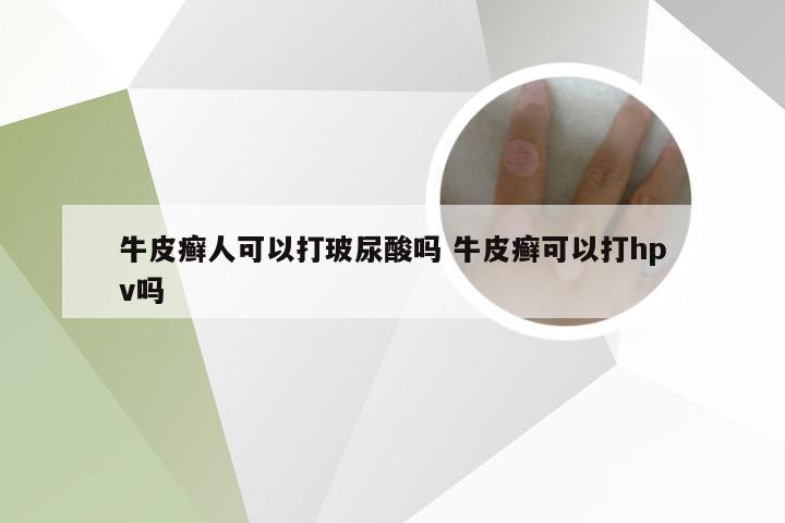 牛皮癣人可以打玻尿酸吗 牛皮癣可以打hpv吗