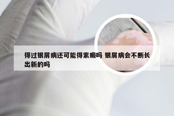 得过银屑病还可能得紫癜吗 银屑病会不断长出新的吗