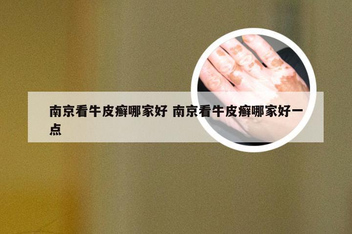南京看牛皮癣哪家好 南京看牛皮癣哪家好一点