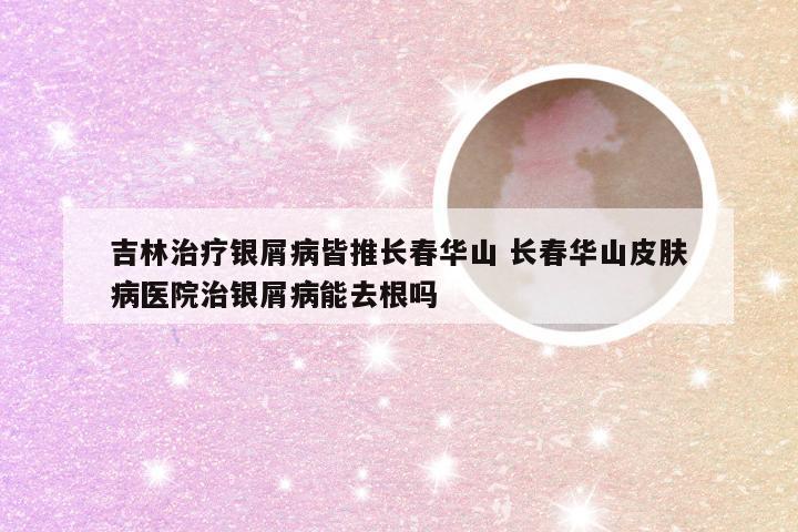 吉林治疗银屑病皆推长春华山 长春华山皮肤病医院治银屑病能去根吗