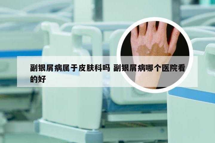 副银屑病属于皮肤科吗 副银屑病哪个医院看的好