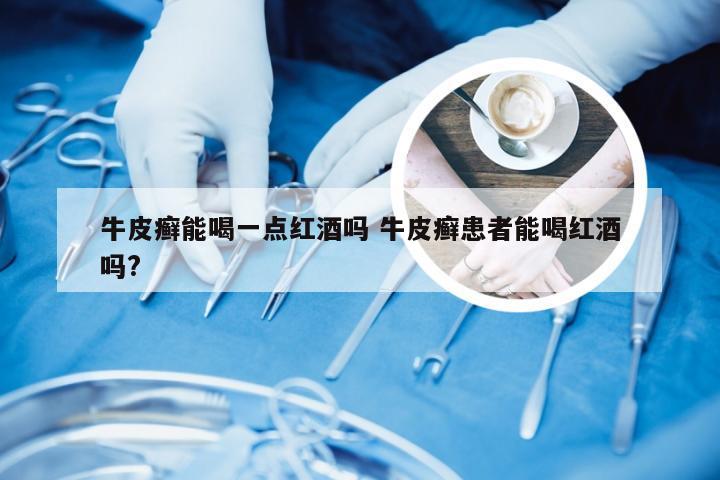 牛皮癣能喝一点红酒吗 牛皮癣患者能喝红酒吗?