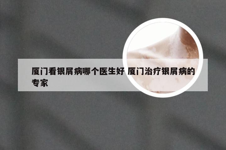 厦门看银屑病哪个医生好 厦门治疗银屑病的专家