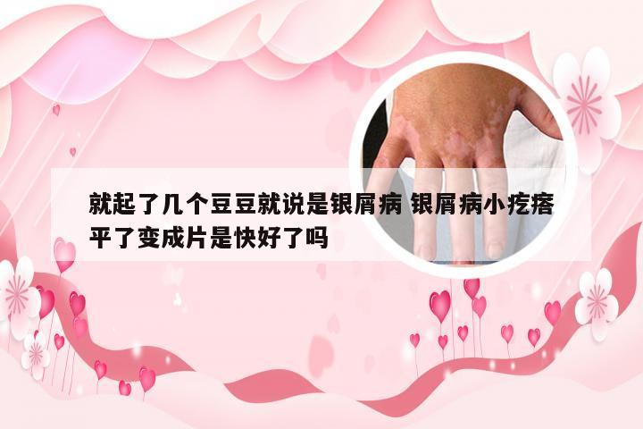 就起了几个豆豆就说是银屑病 银屑病小疙瘩平了变成片是快好了吗