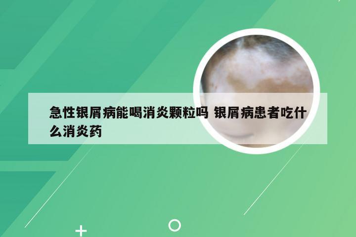 急性银屑病能喝消炎颗粒吗 银屑病患者吃什么消炎药