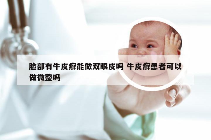 脸部有牛皮癣能做双眼皮吗 牛皮癣患者可以做微整吗