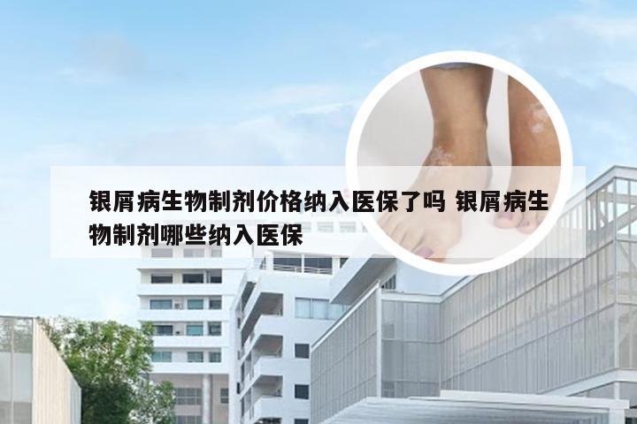 银屑病生物制剂价格纳入医保了吗 银屑病生物制剂哪些纳入医保