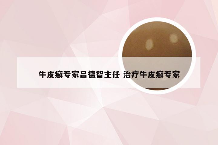 牛皮癣专家吕德智主任 治疗牛皮癣专家