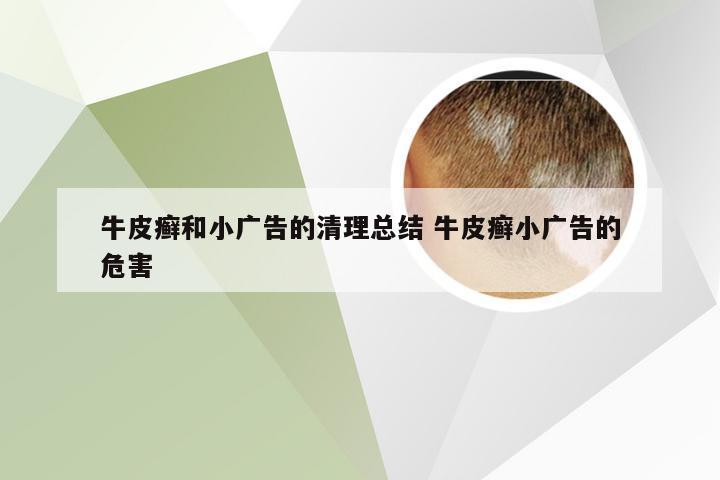 牛皮癣和小广告的清理总结 牛皮癣小广告的危害
