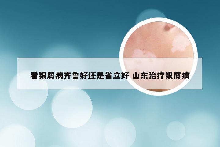 看银屑病齐鲁好还是省立好 山东治疗银屑病