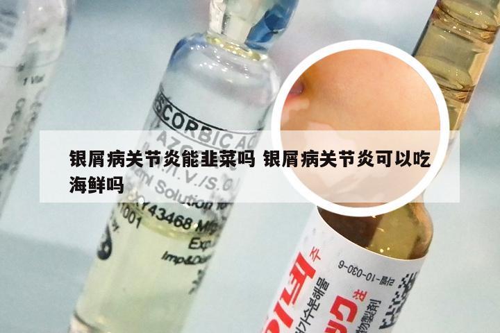 银屑病关节炎能韭菜吗 银屑病关节炎可以吃海鲜吗