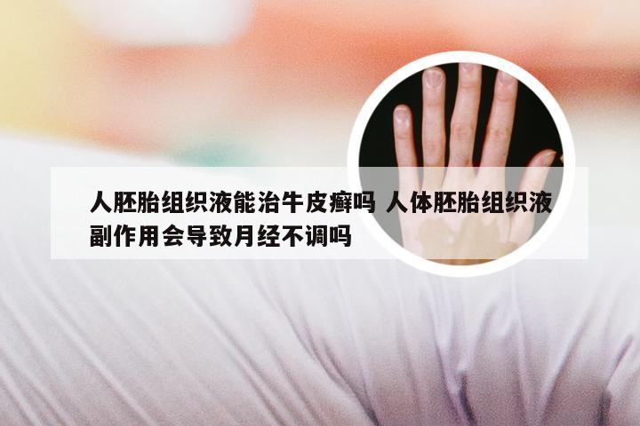 人胚胎组织液能治牛皮癣吗 人体胚胎组织液副作用会导致月经不调吗
