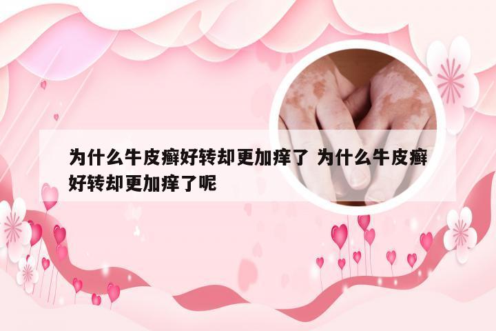 为什么牛皮癣好转却更加痒了 为什么牛皮癣好转却更加痒了呢