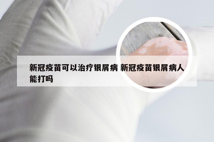 新冠疫苗可以治疗银屑病 新冠疫苗银屑病人能打吗