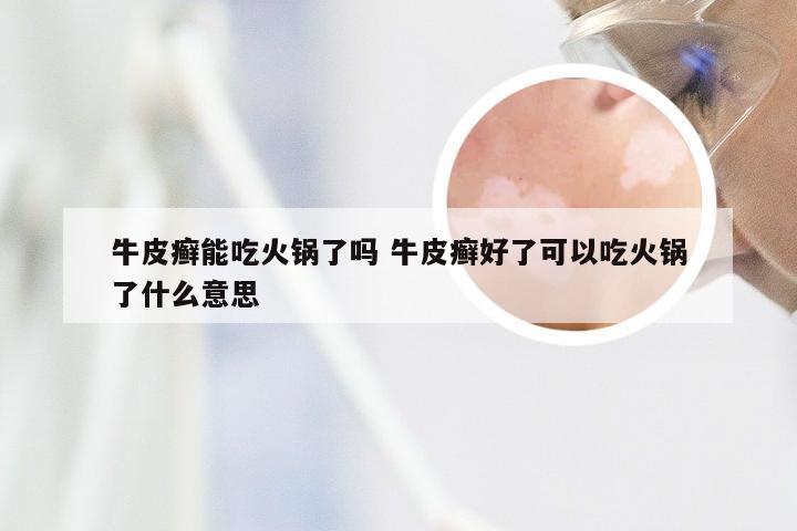牛皮癣能吃火锅了吗 牛皮癣好了可以吃火锅了什么意思