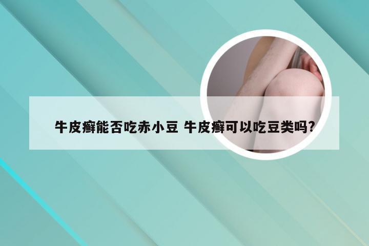 牛皮癣能否吃赤小豆 牛皮癣可以吃豆类吗?
