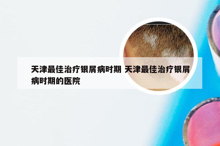 天津最佳治疗银屑病时期 天津最佳治疗银屑病时期的医院