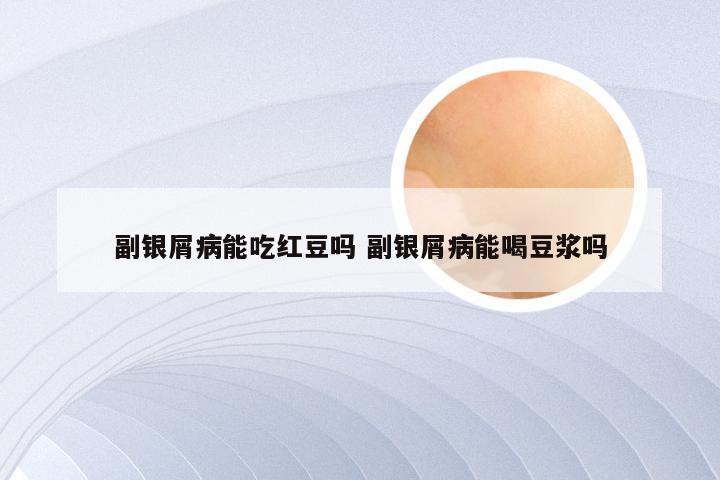 副银屑病能吃红豆吗 副银屑病能喝豆浆吗