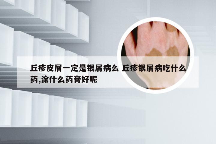 丘疹皮屑一定是银屑病么 丘疹银屑病吃什么药,涂什么药膏好呢