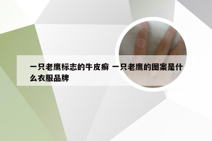 一只老鹰标志的牛皮癣 一只老鹰的图案是什么衣服品牌
