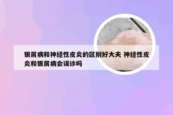 银屑病和神经性皮炎的区别好大夫 神经性皮炎和银屑病会误诊吗