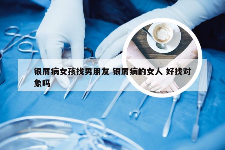 银屑病女孩找男朋友 银屑病的女人 好找对象吗