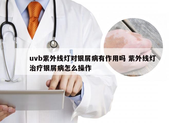 uvb紫外线灯对银屑病有作用吗 紫外线灯治疗银屑病怎么操作