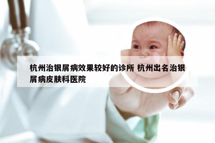 杭州治银屑病效果较好的诊所 杭州出名治银屑病皮肤科医院