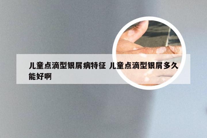 儿童点滴型银屑病特征 儿童点滴型银屑多久能好啊