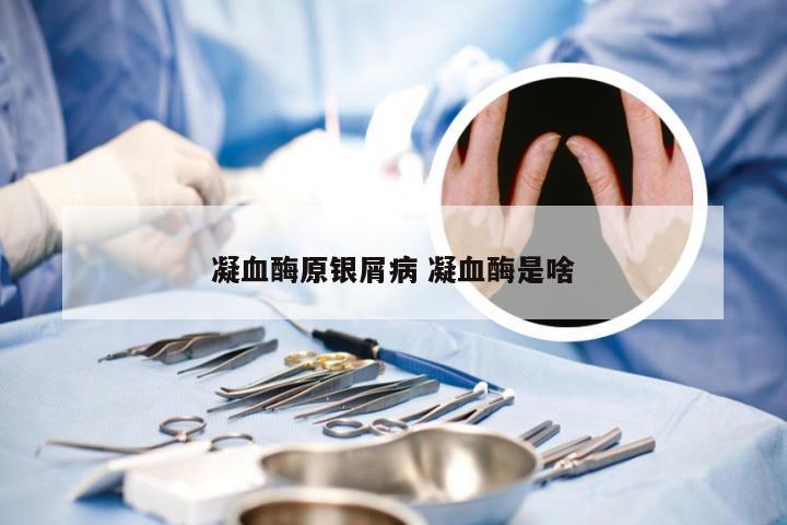 凝血酶原银屑病 凝血酶是啥