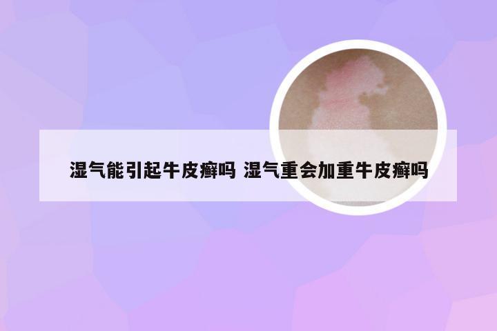 湿气能引起牛皮癣吗 湿气重会加重牛皮癣吗
