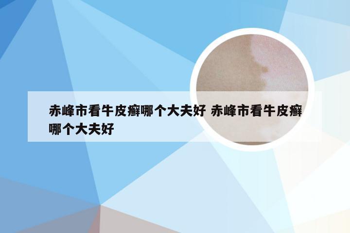 赤峰市看牛皮癣哪个大夫好 赤峰市看牛皮癣哪个大夫好