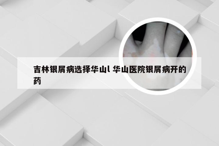 吉林银屑病选择华山l 华山医院银屑病开的药
