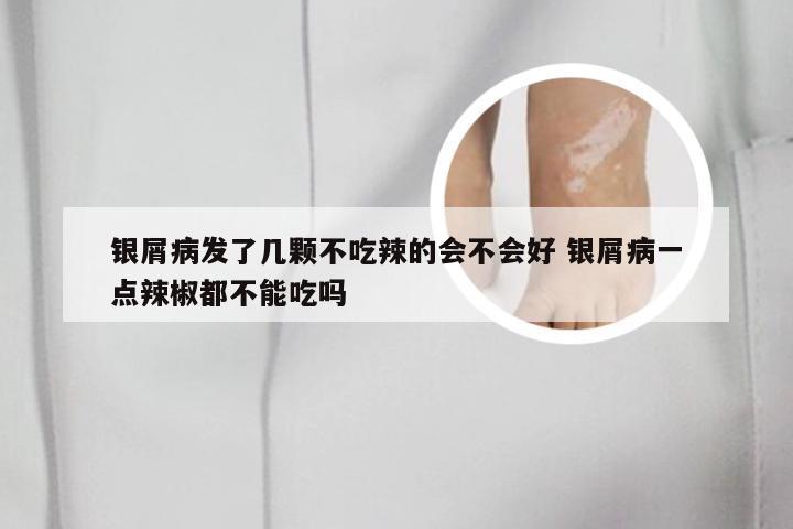 银屑病发了几颗不吃辣的会不会好 银屑病一点辣椒都不能吃吗