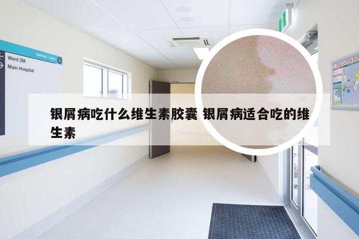 银屑病吃什么维生素胶囊 银屑病适合吃的维生素