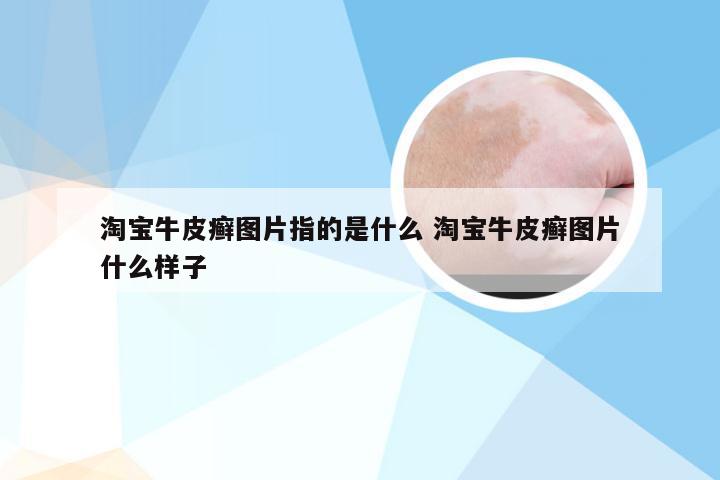 淘宝牛皮癣图片指的是什么 淘宝牛皮癣图片什么样子