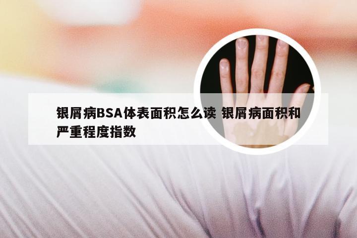 银屑病BSA体表面积怎么读 银屑病面积和严重程度指数